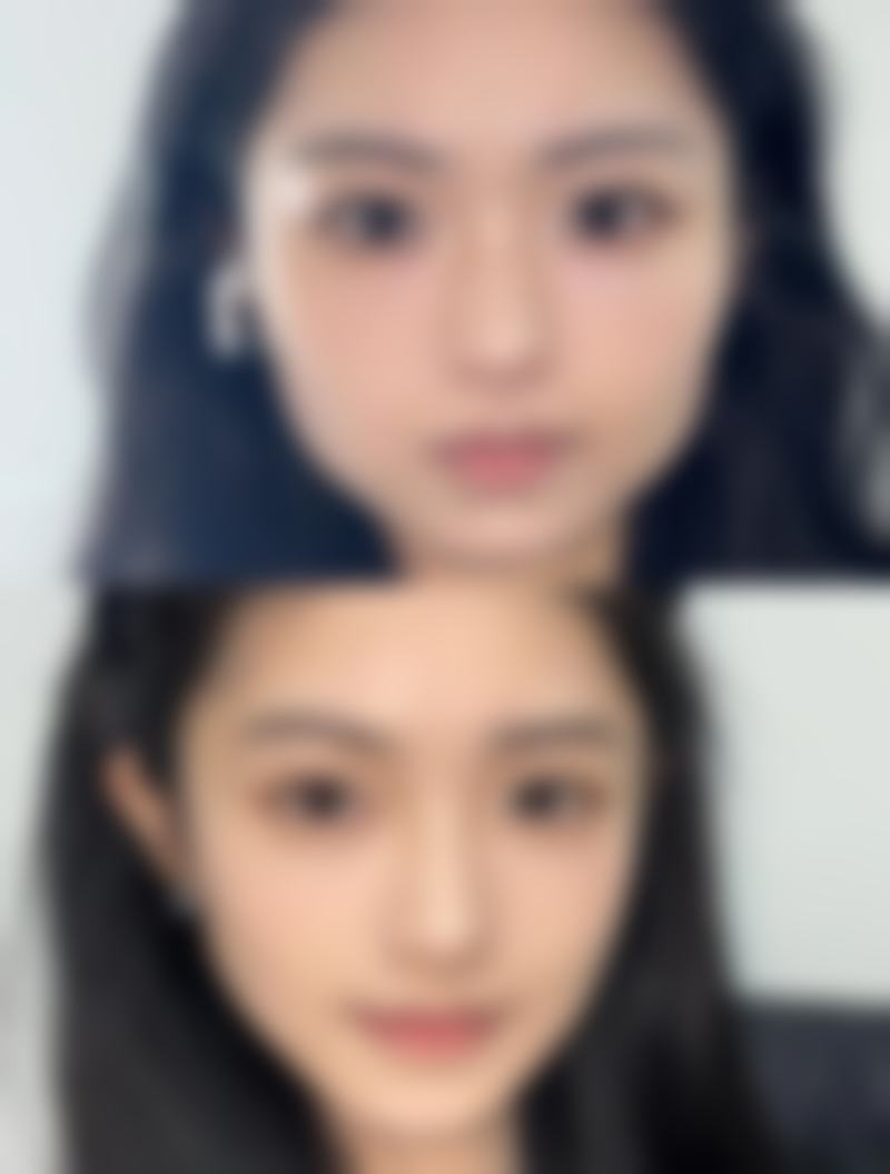 武汉丽比雅医疗美容机构真实实例