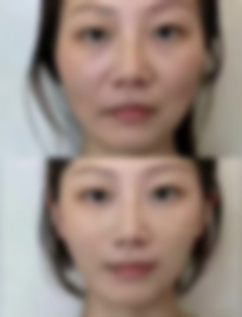 龙口壹美整形美容医院价格表