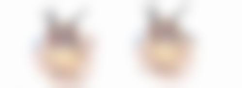 饮食调节对全切双眼皮修复有什么影响