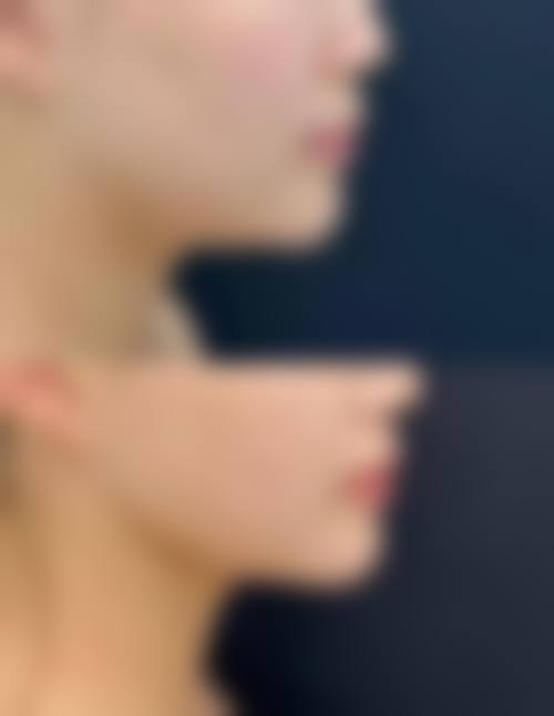 韩国芭比整形外科地址及乘车路线