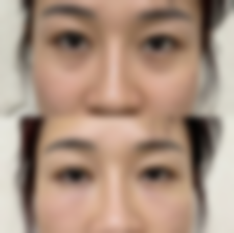 咸宁张佳栋医生真实实例