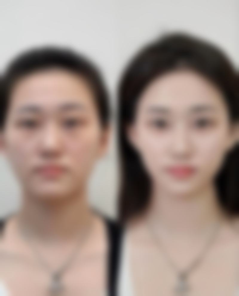 宁波鄞州宸沐整形医院价格表:透明消费,物超所值