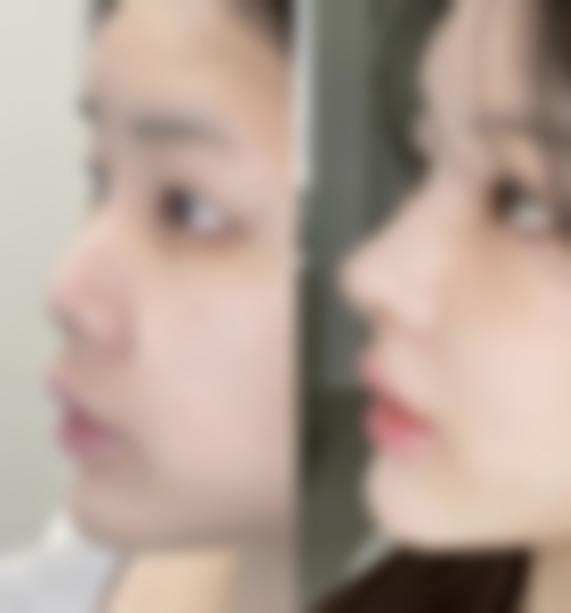 赵四海医生技术特点