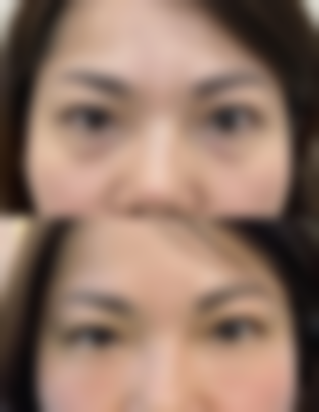 韩国芭比整形外科医生名单