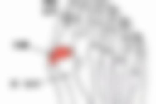 激光去眼袋对改善眼睛有眼袋和皱纹怎么样