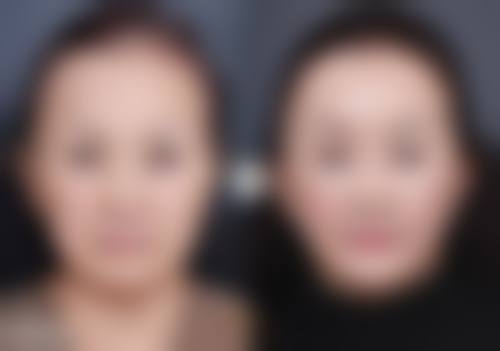 张淑珍医生技术特点