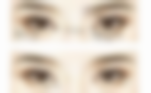 崔贤敏（Choi Hyun - min）院长的看诊优势超贴心