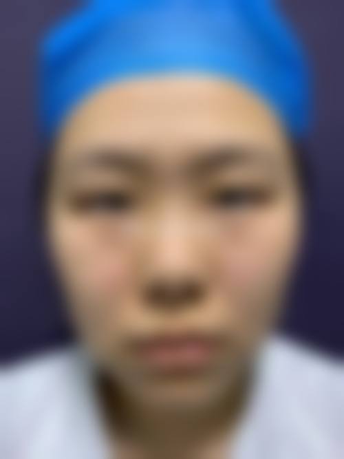 邵阳曹家整形医疗美容门诊部真实实例