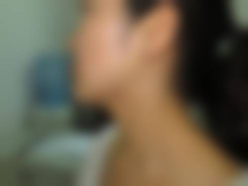 云南百媚医疗美容诊所真实实例