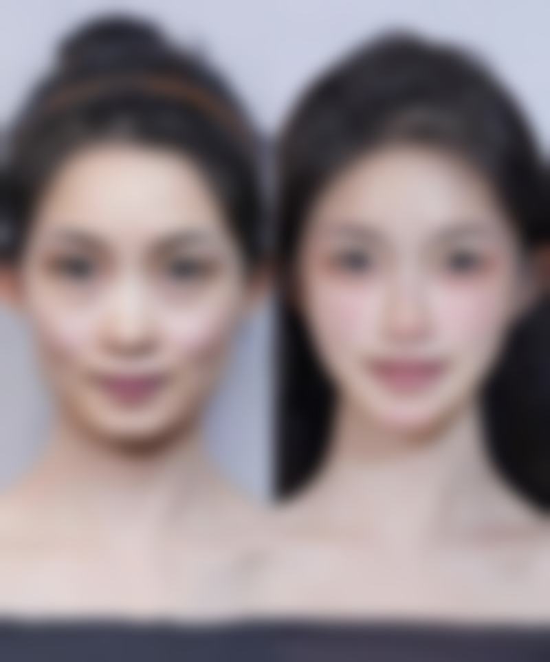 张升医生之北京百达丽医疗美容篇：技术特点