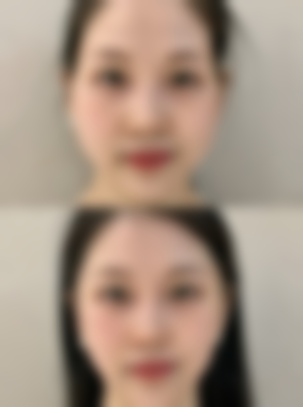 福建省立医院做吸脂适合吗？