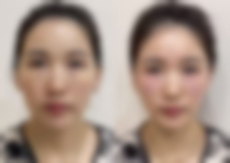 云南百媚医疗美容诊所价格表