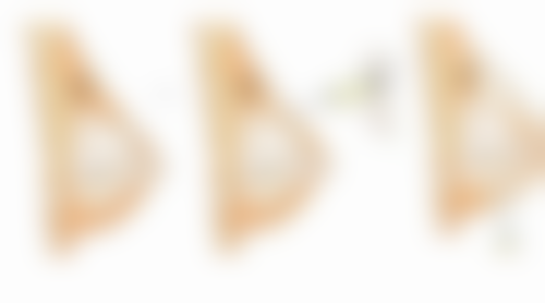 德国热熔眼袋技术成效能维持多久