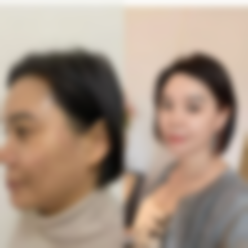 德国热熔眼袋技术值不值3800元