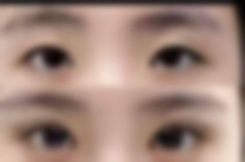 按摩对软化硬疤有成效吗