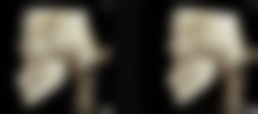 许昌正美韶华医疗整形郝文玉医生收费合理吗