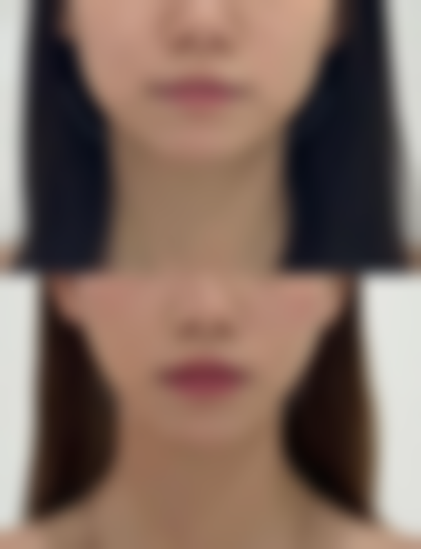 韩国好身材医院口碑怎么样