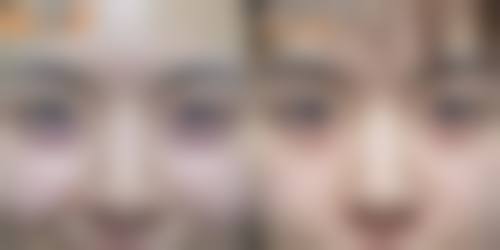 潘会章医生技术特点