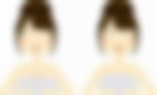 做完双眼皮不忌口会让愈合缓慢吗