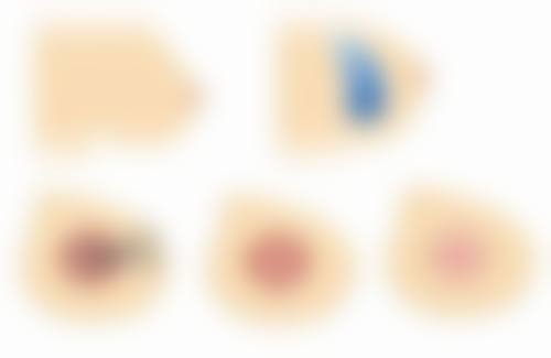 医美马磊医生怎么预约挂号