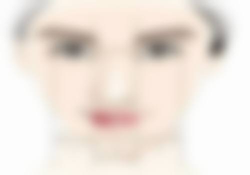 石琼医生的技术特点