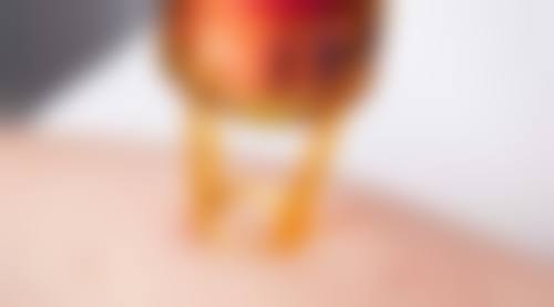 做完双眼皮不忌口容易留疤吗