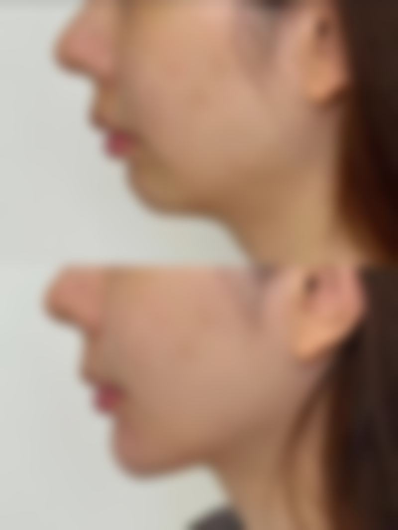 蒋翔峰医生技术特点