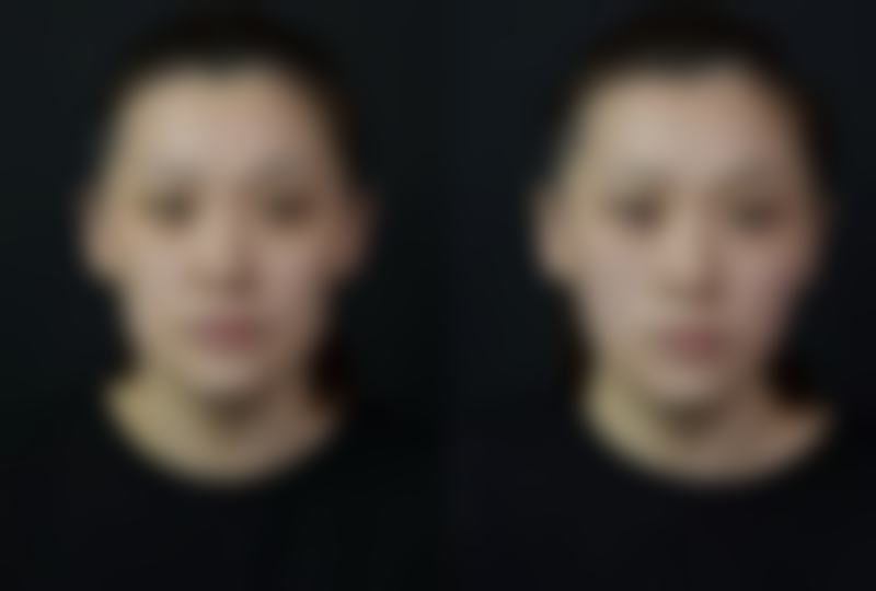 成都美芯东裕整形医院价格表