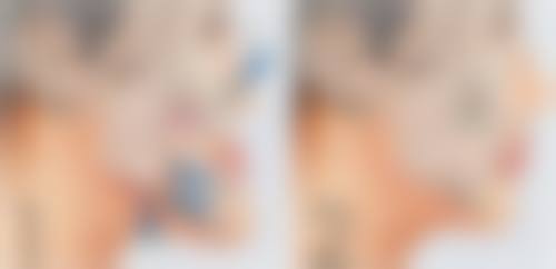 金奇出看诊优势：个性化服务的贴心关怀