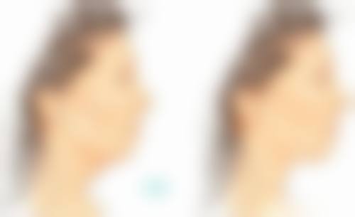 卢祖初医生技术特点