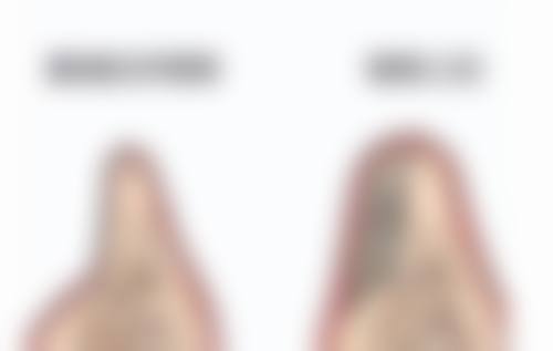 朱凯隆医生擅长项目