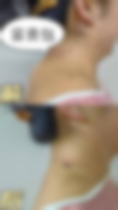 哈尔滨二四二医院美容整形科口碑怎么样