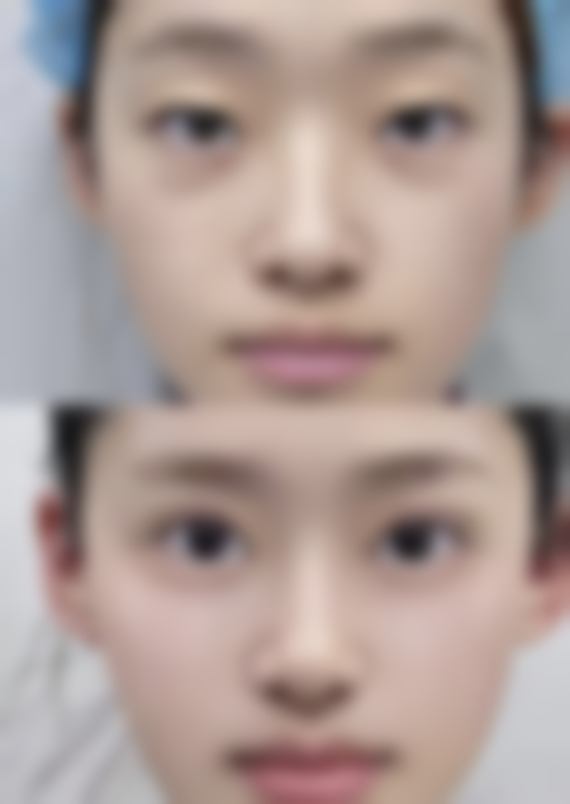 杨占杰医生怎么预约挂号:多种方式任你选