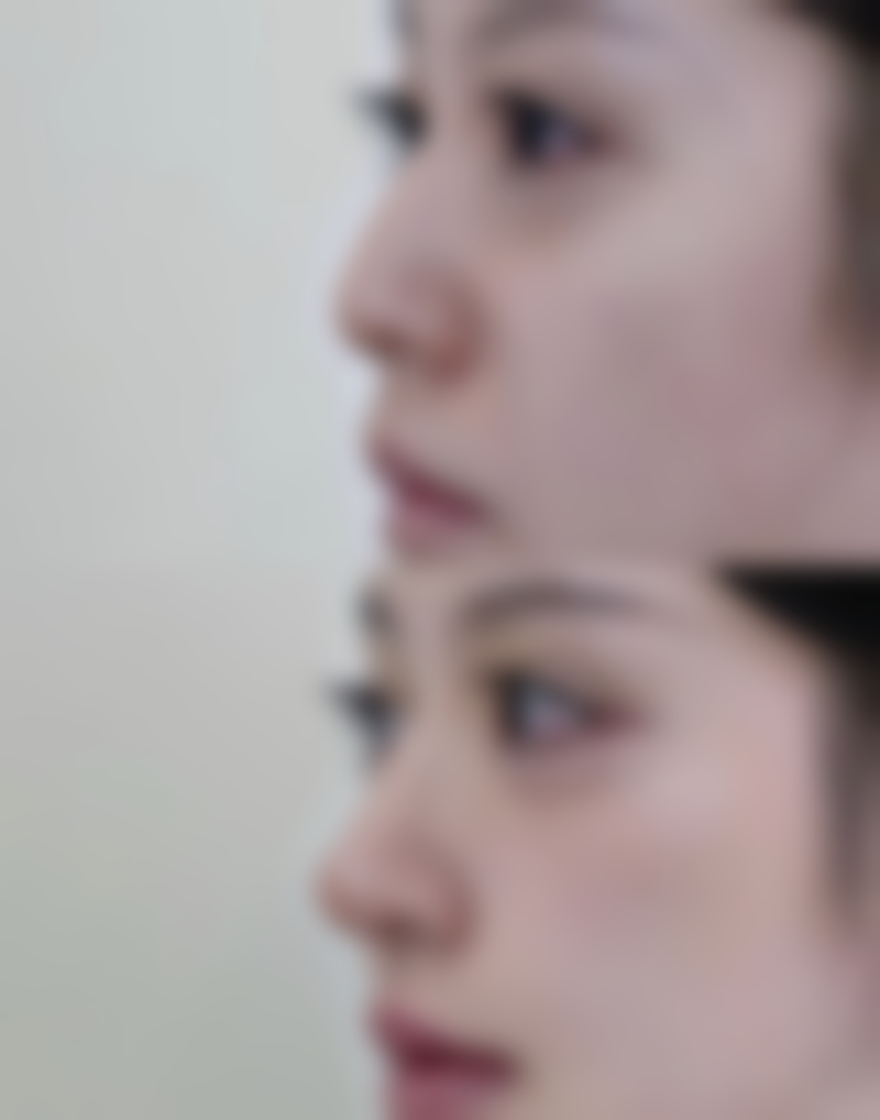 洛阳肖胜利整形医疗美容诊所价格表