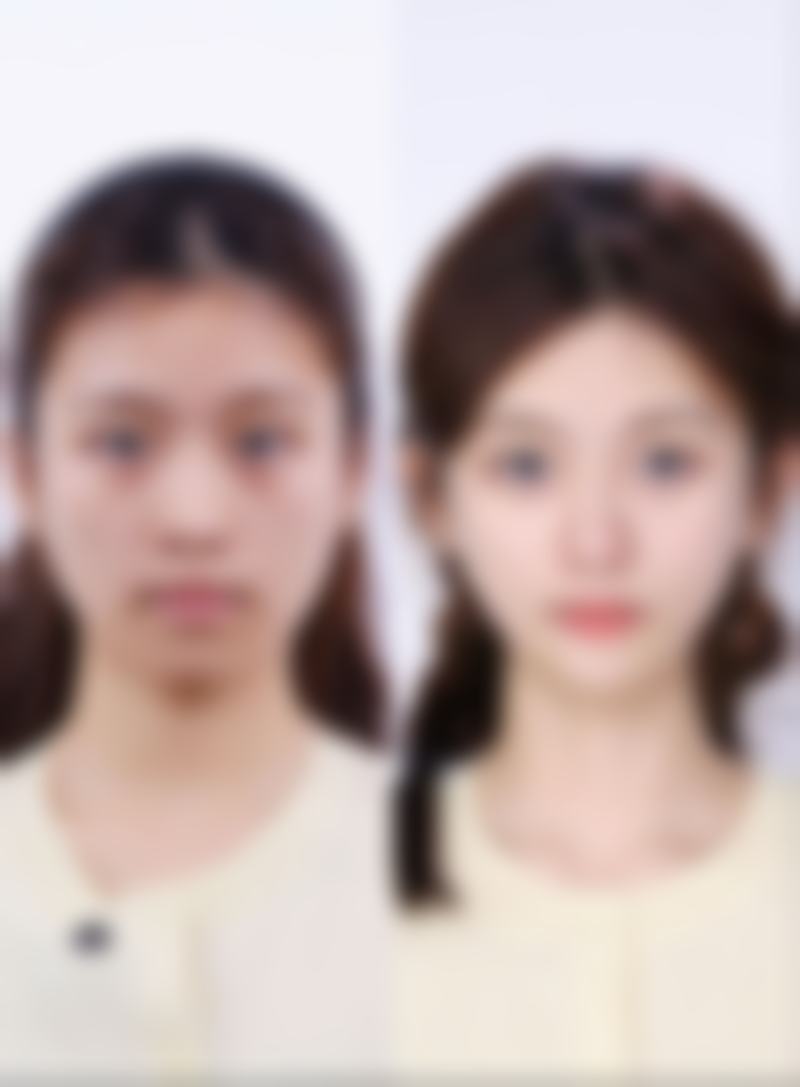 卢祖初医生真实实例