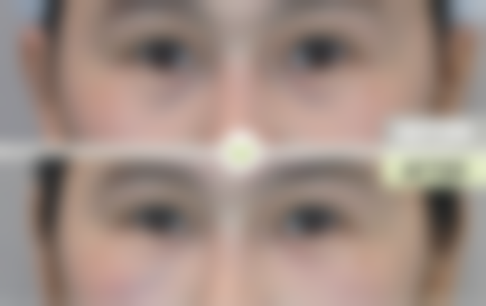 洪珠銑医生看诊优势