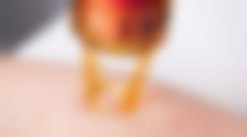 郑州芊美医疗美容医院仪器设备：精良技术助力美丽