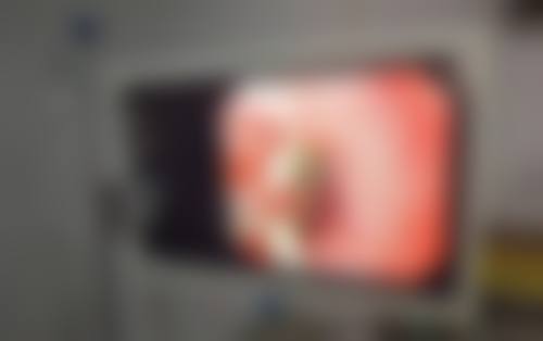 深圳呈悦整形医疗美容门诊部口碑怎么样