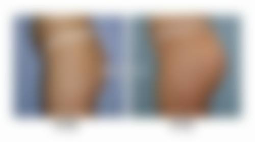 达州熙之医学美容诊所擅长项目：满足你的多样需求