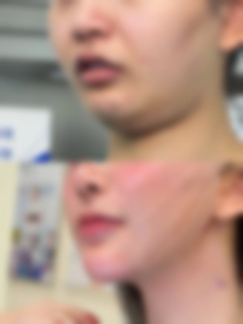 邹同荣医生擅长项目：高能医美骨干医生，满足多样需求