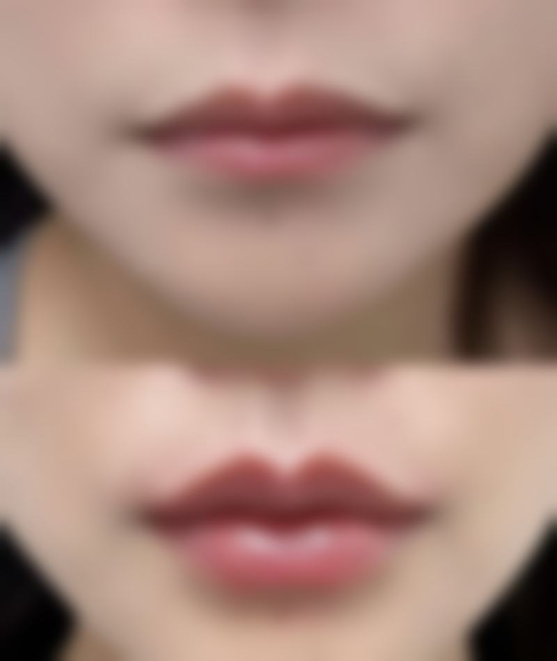 达州熙之医学美容诊所价格表：透明消费更放心