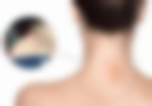 广州柏尔整形医院预约挂号方式：便捷开启美丽之旅