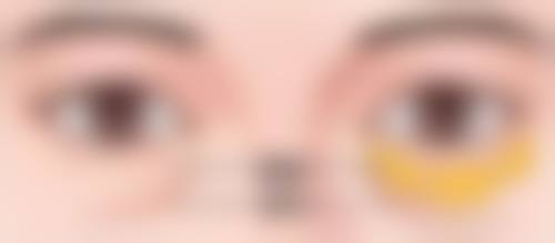 三岁宝宝的缝针疤痕多久可以激光治疗?了解最佳治疗时间，让宝宝早日摆脱疤痕烦恼重绽可爱笑容！ 