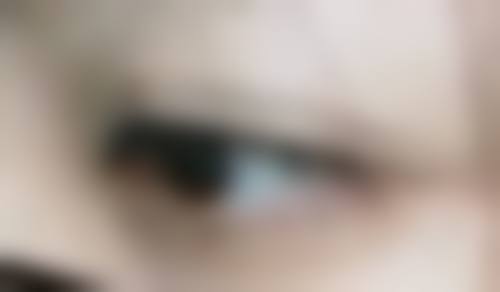 光子嫩肤和瘦脸针能一起做吗？权威解答：通常不建议一起做，分开进行效果好又保障安全！ 