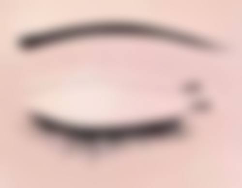 三岁宝宝缝针疤痕激光治疗值不值?