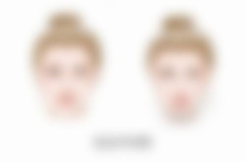 光子嫩肤和瘦脸针一起做成效怎么样