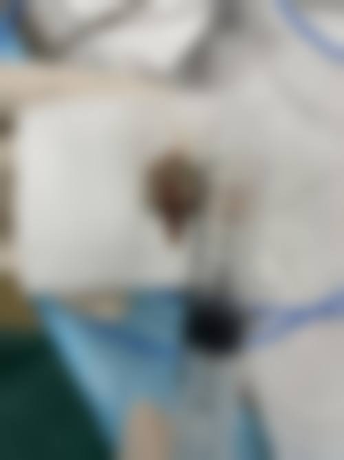 兰州毓丽医疗整形门诊部真实实例