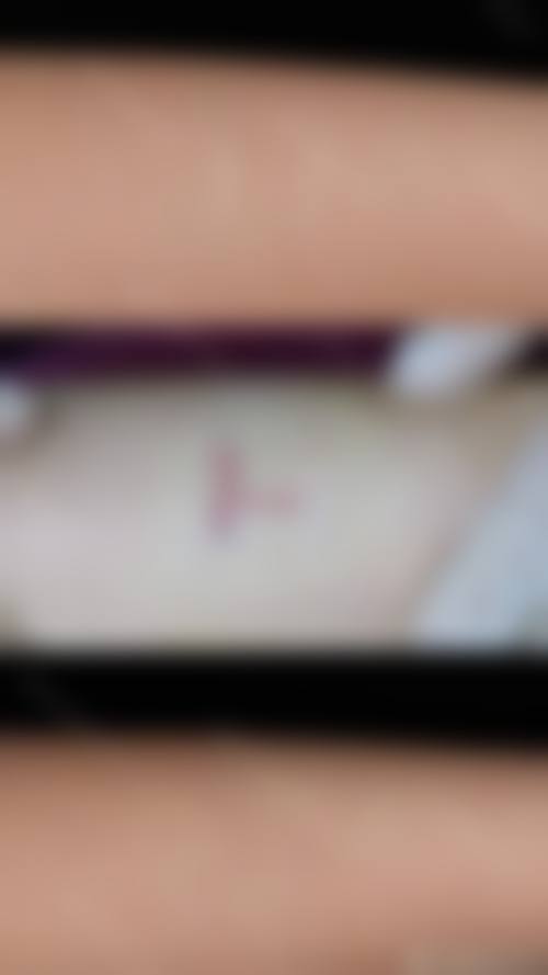 温州韩薇儿整形医院价格表