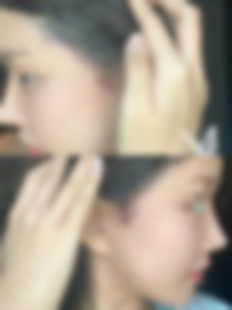 刘丽敏主治医师的技术特点超独特