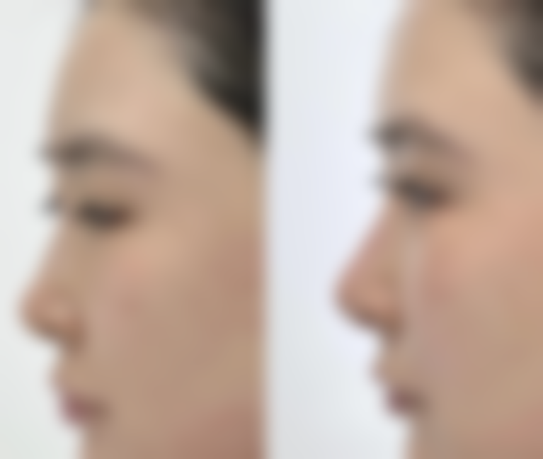 陆黛咪医生真实实例